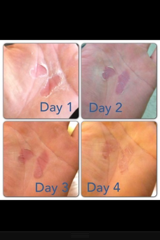 Baume réparateur RipFix